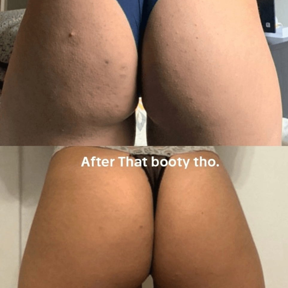 Alejandra's routine for a smooth booty - Anese