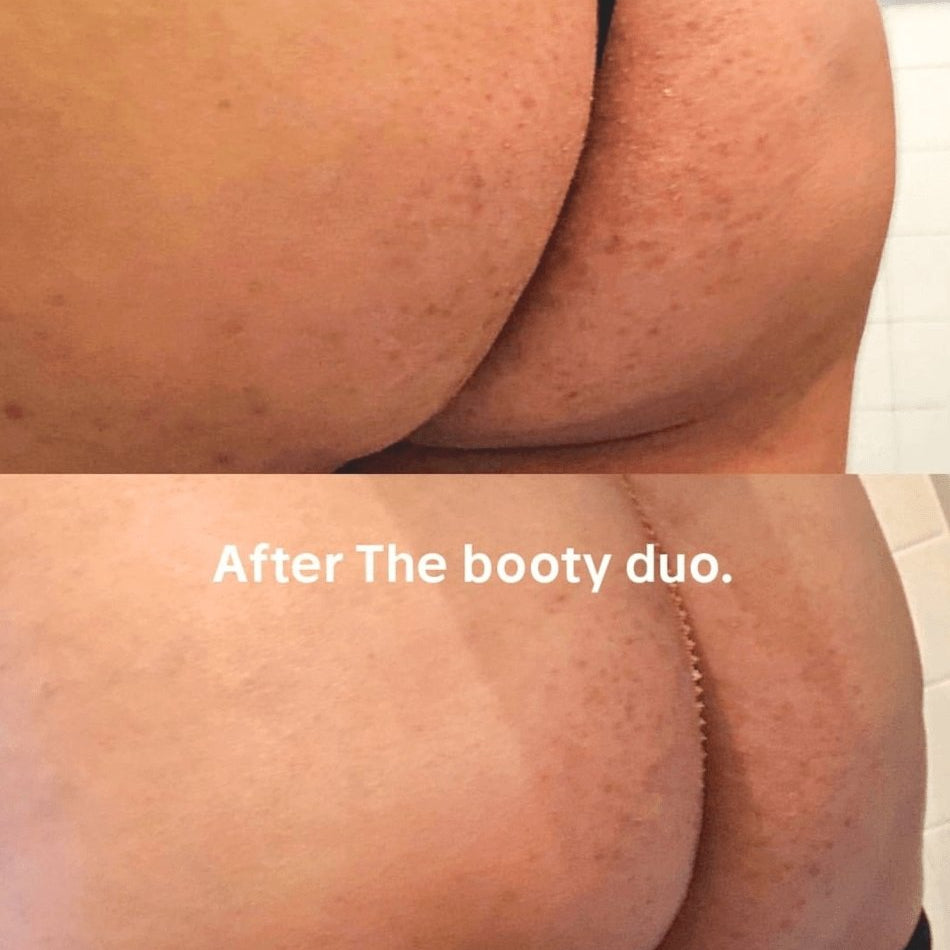 Noelia uses the Booty Duo to improve her skin. - Anese