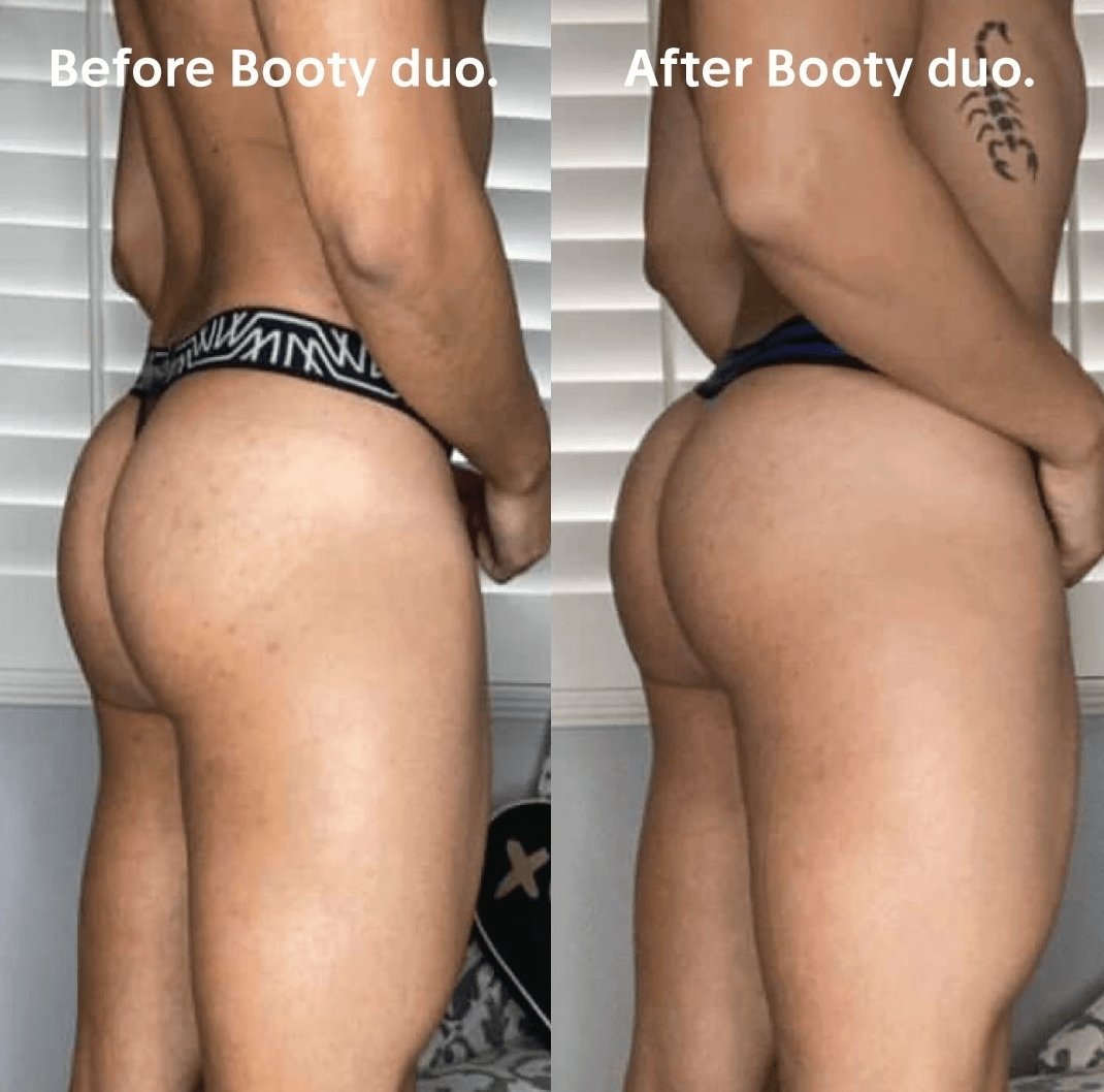 After one month this dance instructor saw a reduction in acne, stretch marks and a smoother booty. - Anese