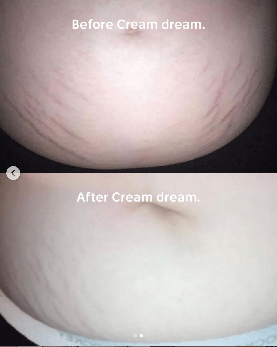 Cream Dream's Visible Results! - Anese