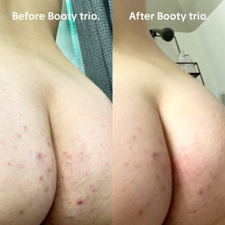 Results from the Booty Duo